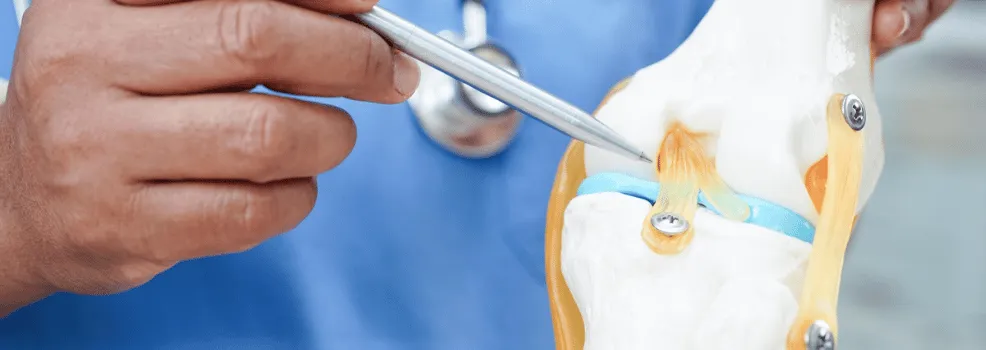 Meniscus Tear